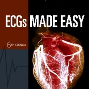 ECGs Made Easy 6th Edition Aehlert - Test Bank